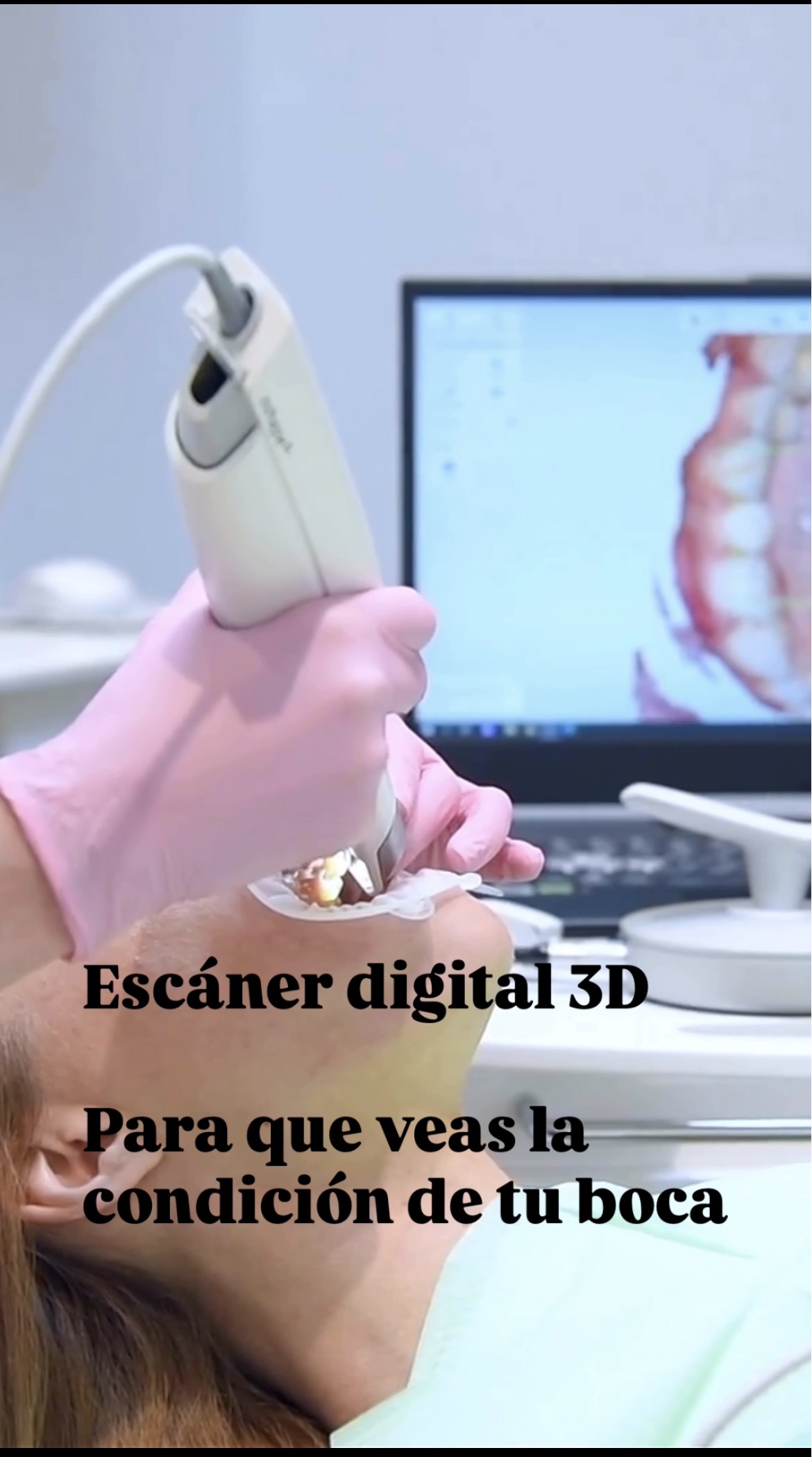 Escáner digital 3D en Maple Dental Cartagena